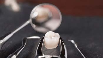 Dental forceps holding tooth in Metairie