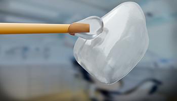 a close-up digital rendering of a veneer